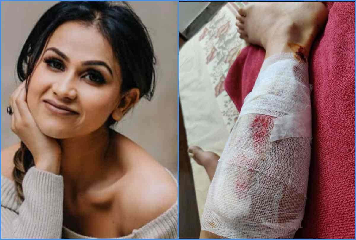 mujhse shaadi karoge fame aanchal khurana has injured