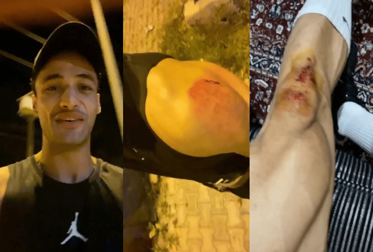 Asim Riaz Attack News: bigg boss ex contestant Asim Riaz injured in accident hit by bike rider