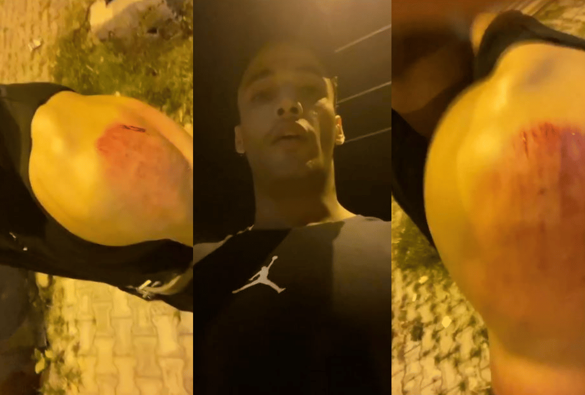Asim Riaz Attack News: bigg boss ex contestant Asim Riaz injured in accident hit by bike rider