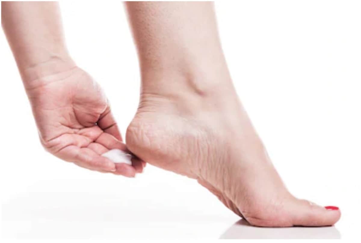 repair crack heels with help of wax and mustard seed oil