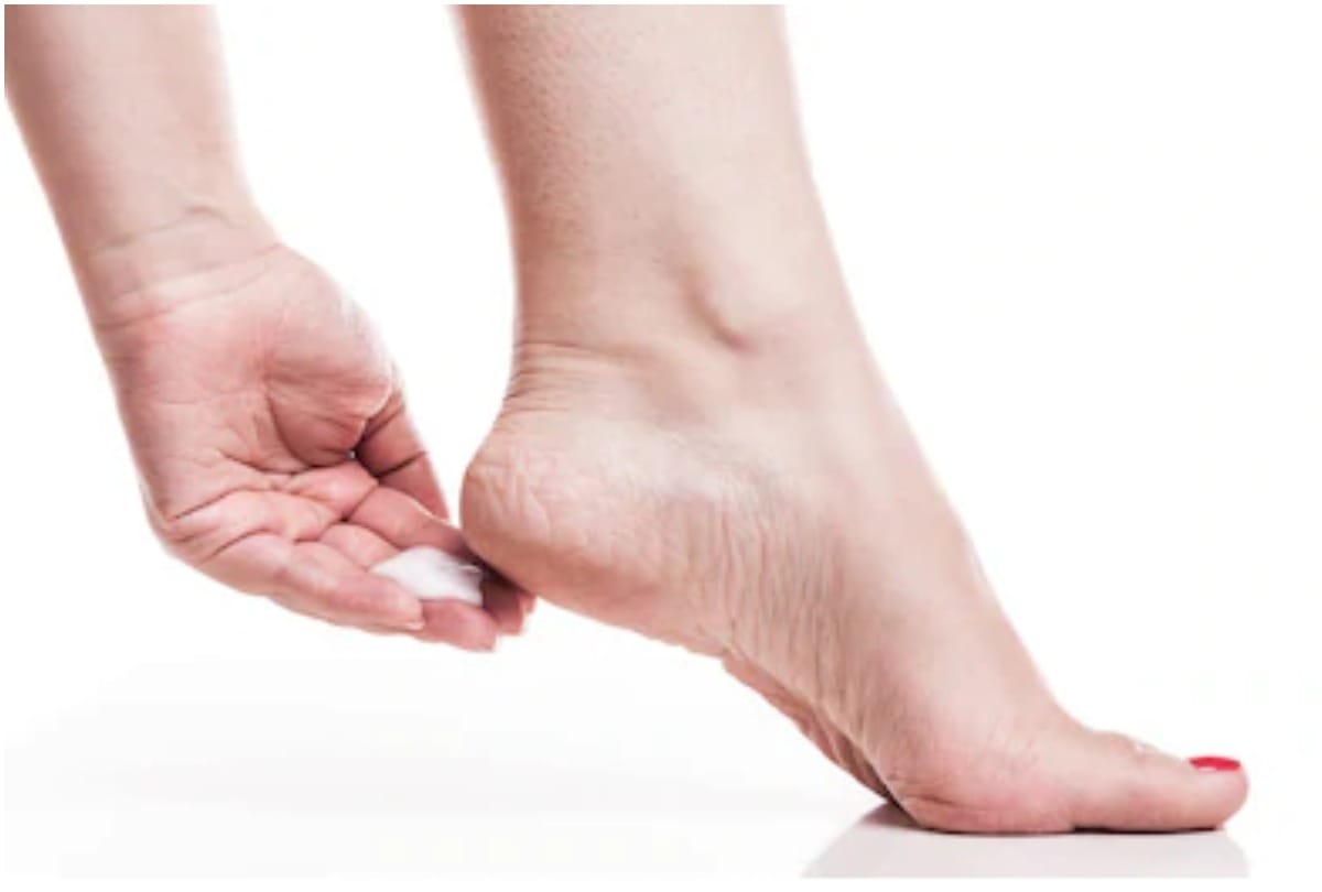 Beauty tips home remedies to get rid of cracked heels