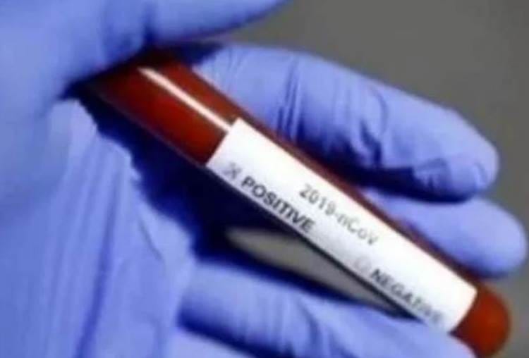 six patients died, 707 corona positive found in lucknow