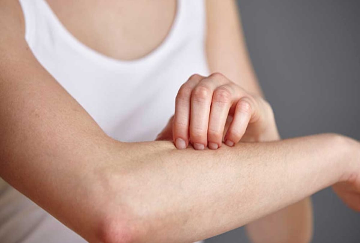 itching home remedies treatment for skin rashes cure how to get relief from itchy skin khujli ke gharelu upay