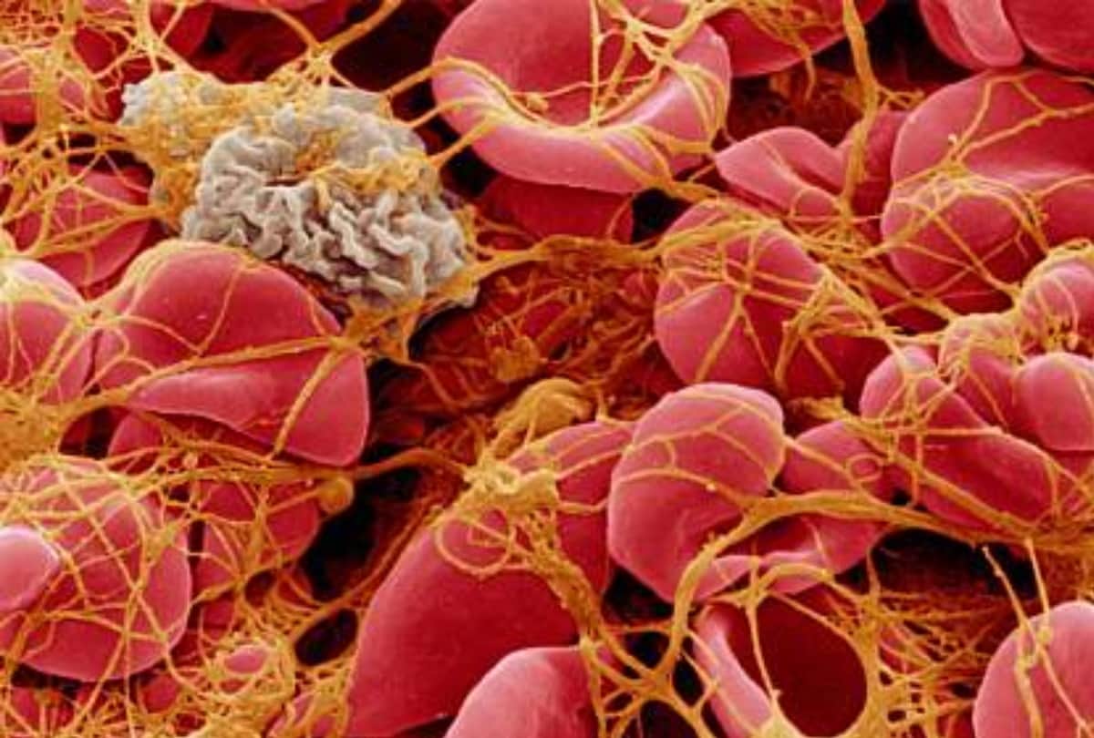Corona alert for Respiratory patients most at risk from corona virus