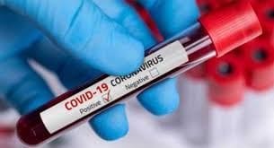 Aligarh: 54 with 14 women infected with corona virus