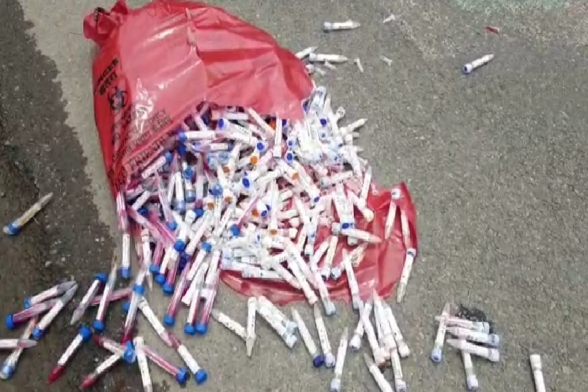 Sample collection tubes of Corona investigation spread on the road, there was a stir