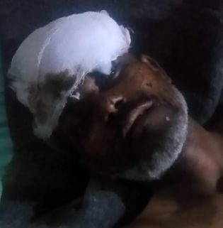 Farmer found injured on railway line