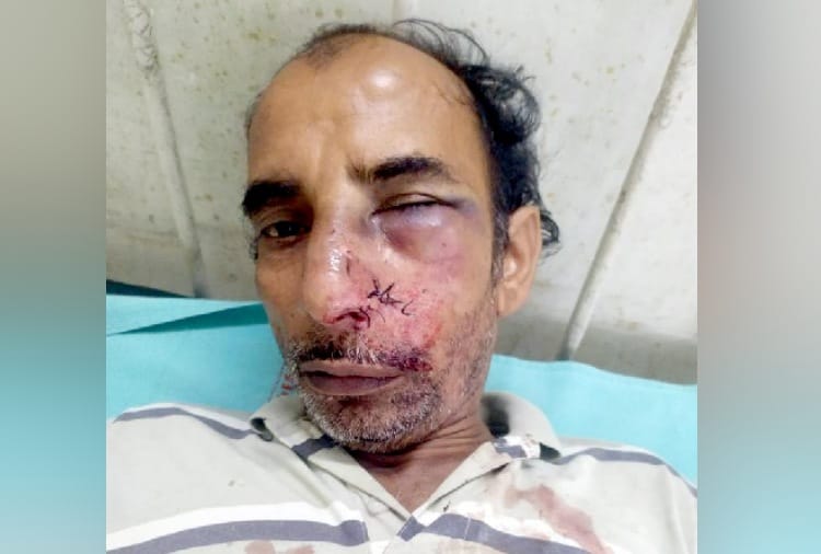 Haryana News in Hindi: Attack on irrigation department employees in Hisar of Haryana