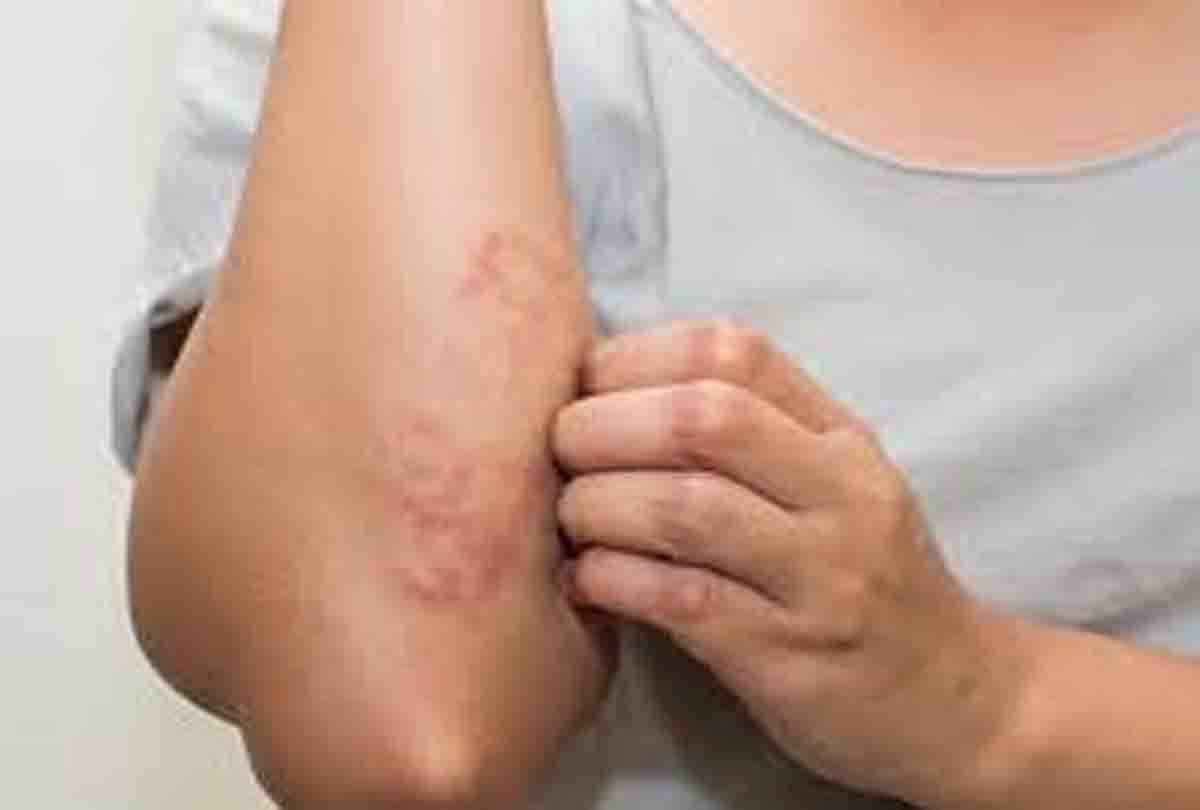 More than 50 people are sick in ghatampur
