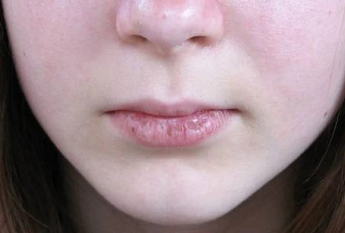 benefits importance of mustard oil sarso oil helps in skin care and cold cough