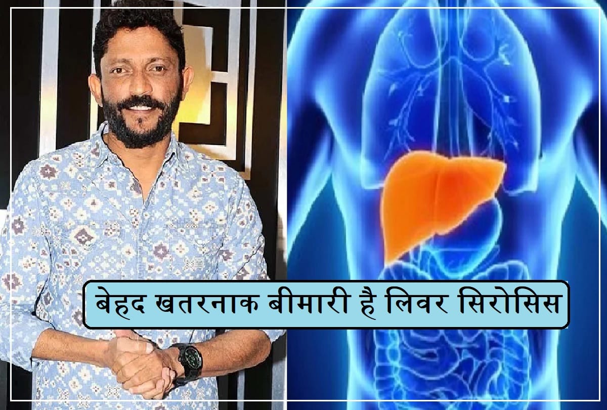 Bollywood actor Director Nishikant Kamat death by liver cirrhosis Symptoms Causes and Treatment