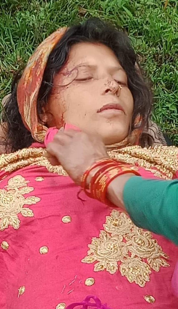 Woman injured by slipping grass cutting forest, higher center referred