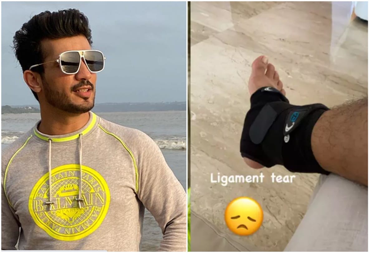 Actor Arjun Bijlani gets injured while vacationing in Goa