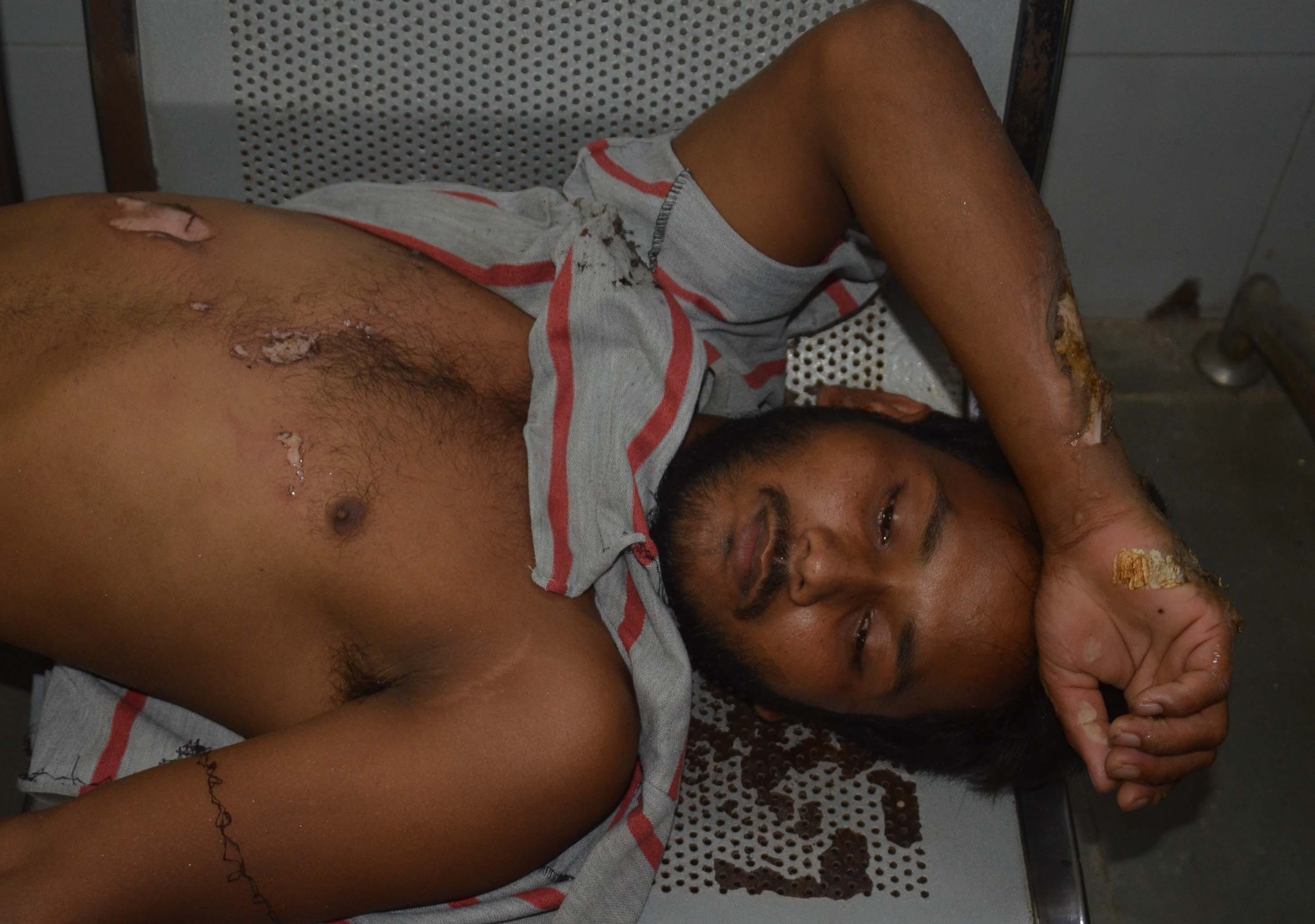 Pratapgarh: Contractor connecting high tension line dies due to current, four villagers also scorched