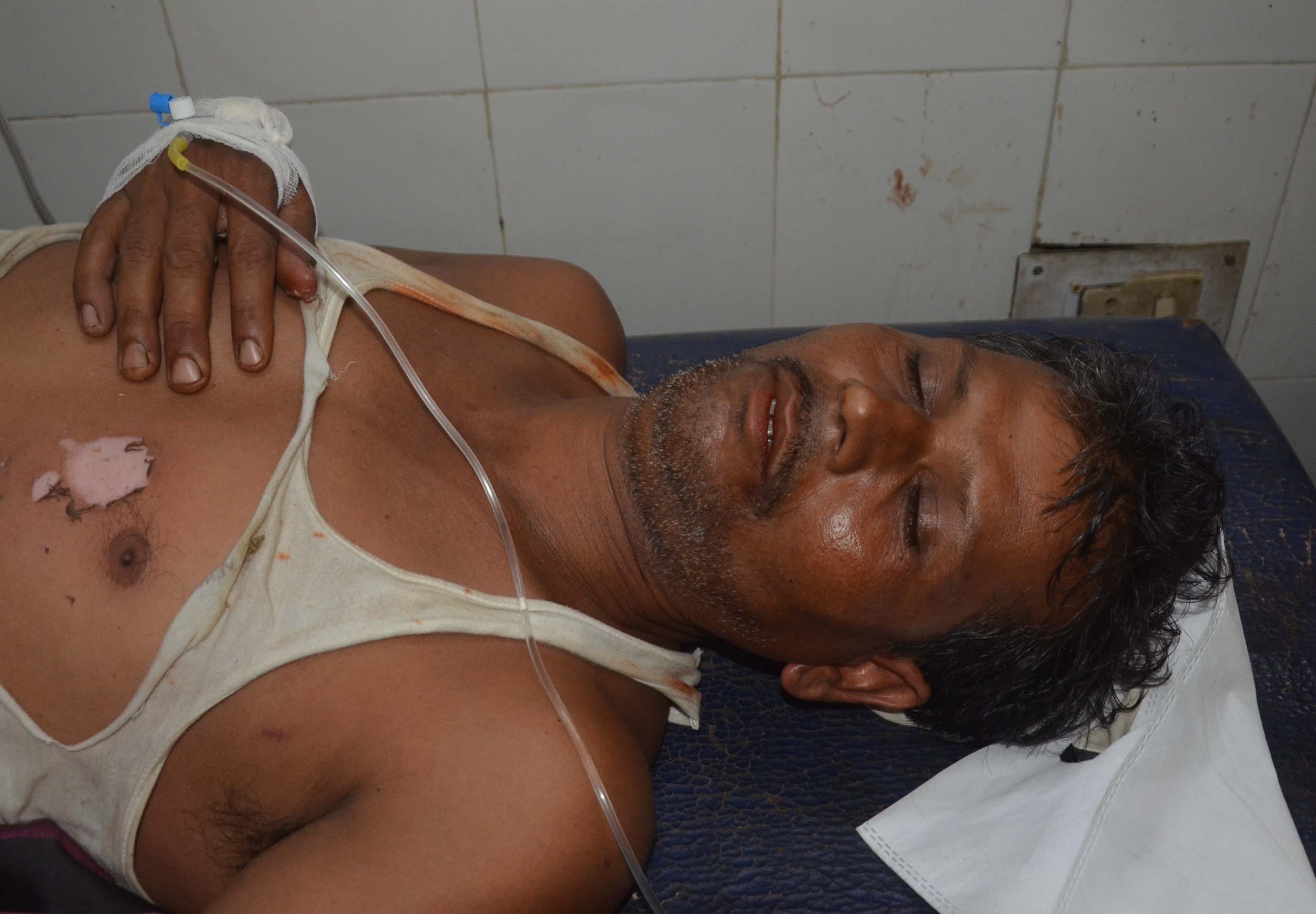 Pratapgarh: Contractor connecting high tension line dies due to current, four villagers also scorched