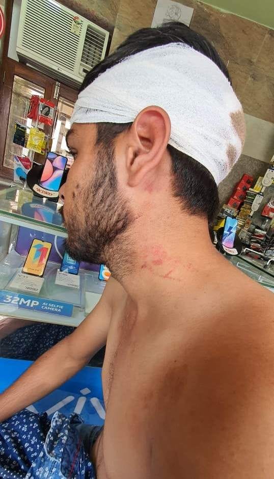 Wounded after attacking with sharp weapon