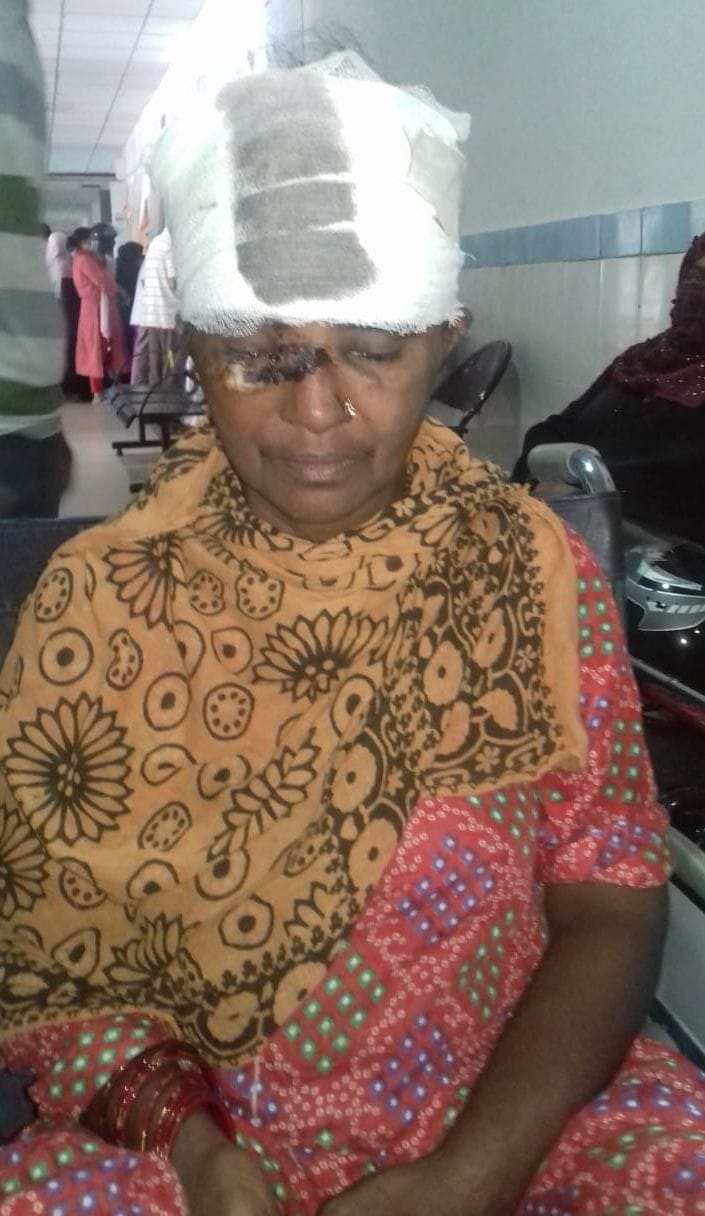 The tiger attacked the woman who went to the goat