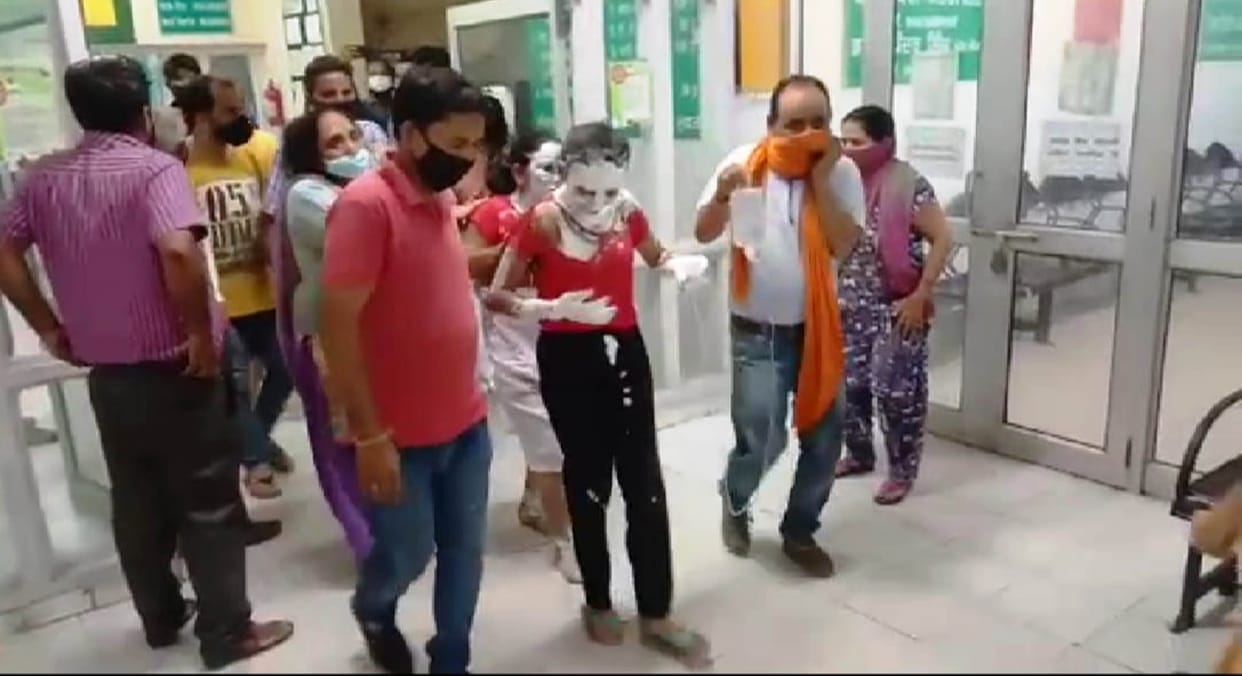 people scorched due to fire in cylinder