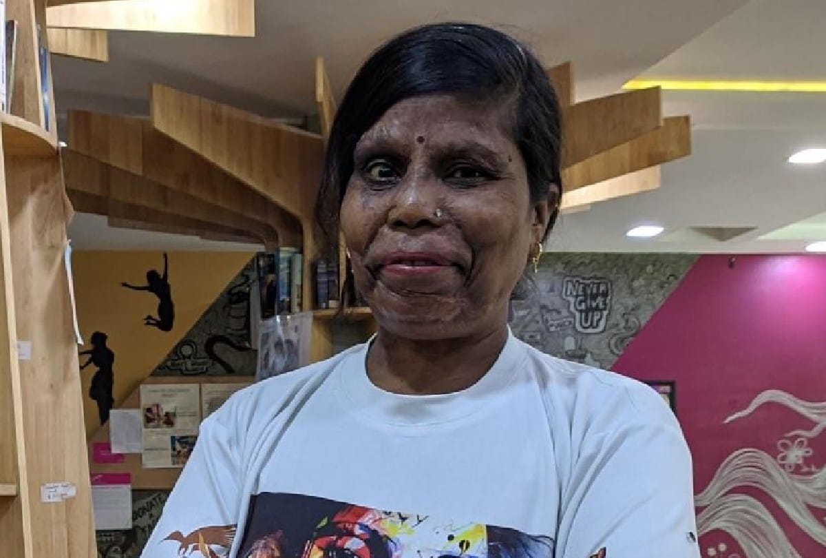 Aparajita 100 Million Smiles struggle story of acid attack survivors