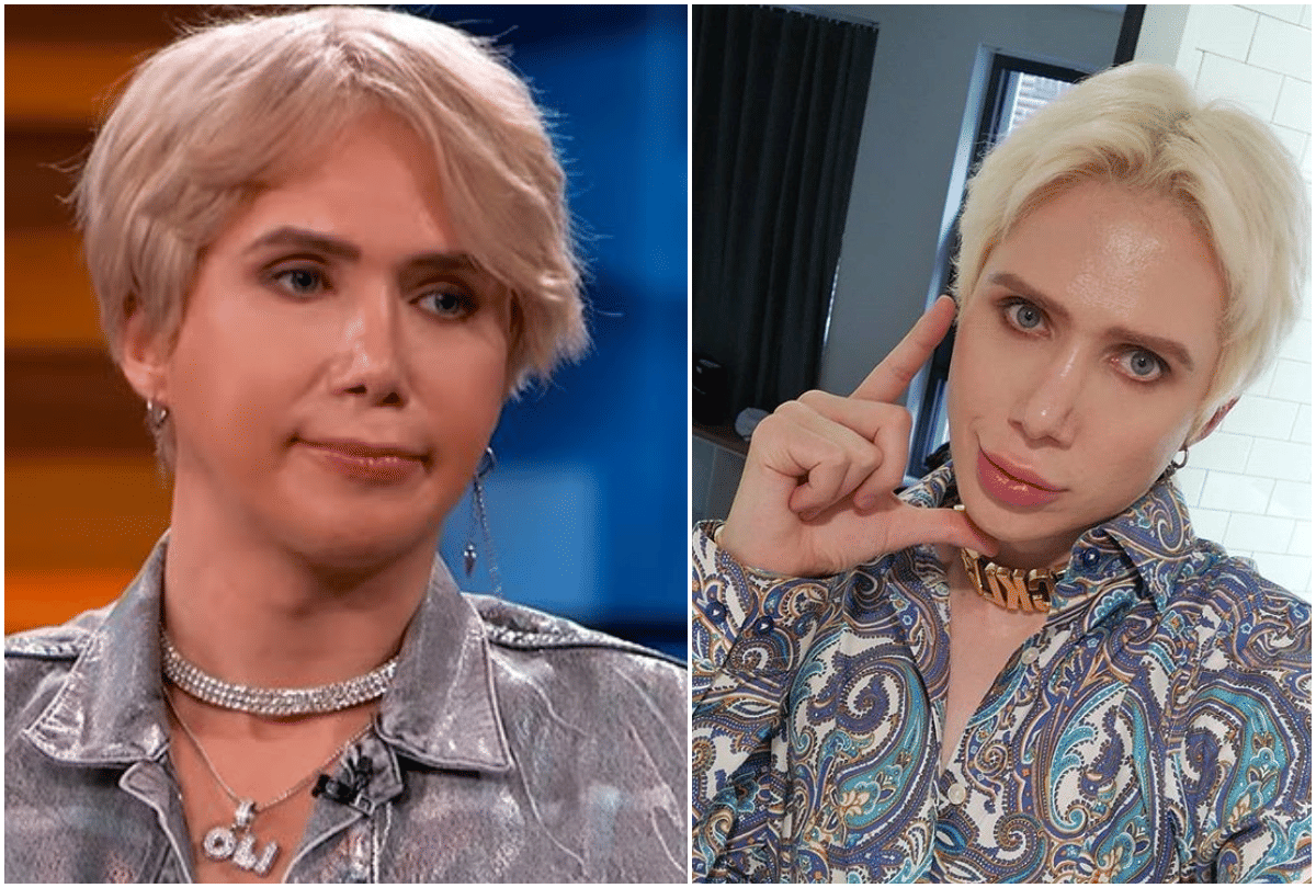 pop singer bts superfan oli london spend 1 crore 12 lakh rupees on cosmetic surgery to look likes ideal