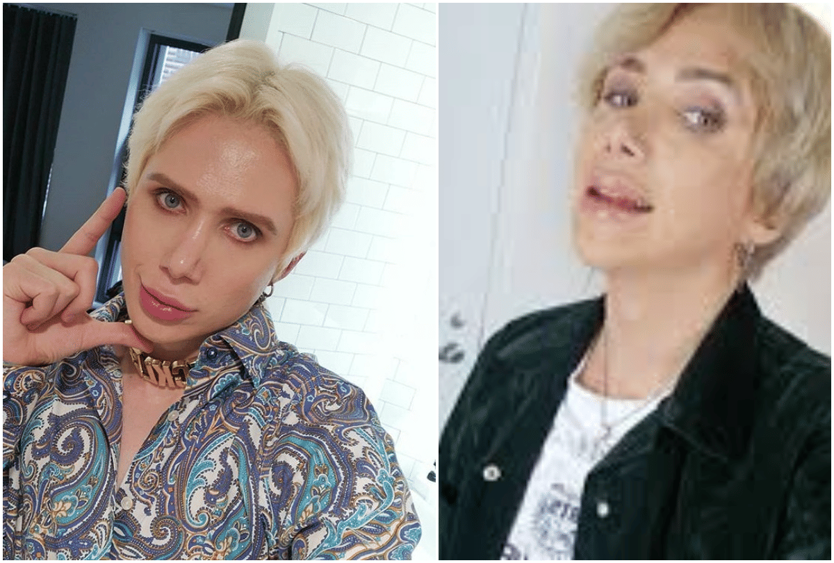 pop singer bts superfan oli london spend 1 crore 12 lakh rupees on cosmetic surgery to look likes ideal
