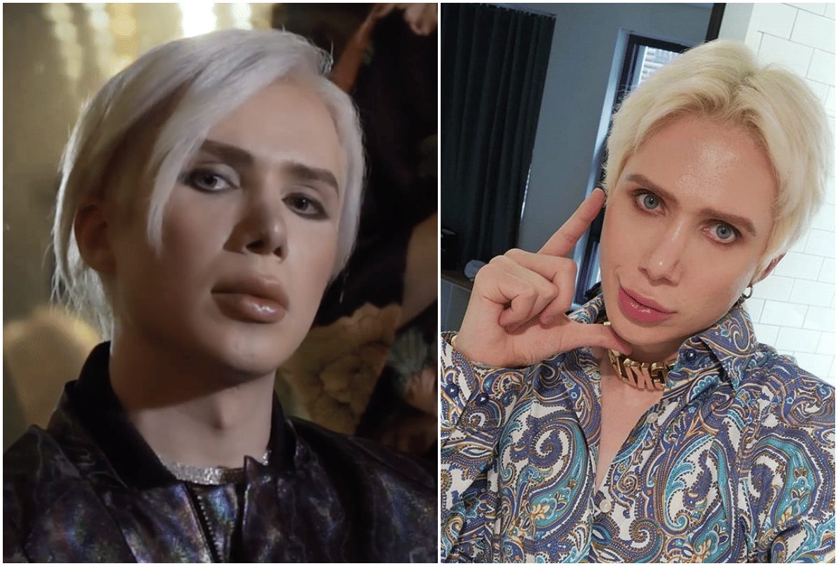 pop singer bts superfan oli london spend 1 crore 12 lakh rupees on cosmetic surgery to look likes ideal