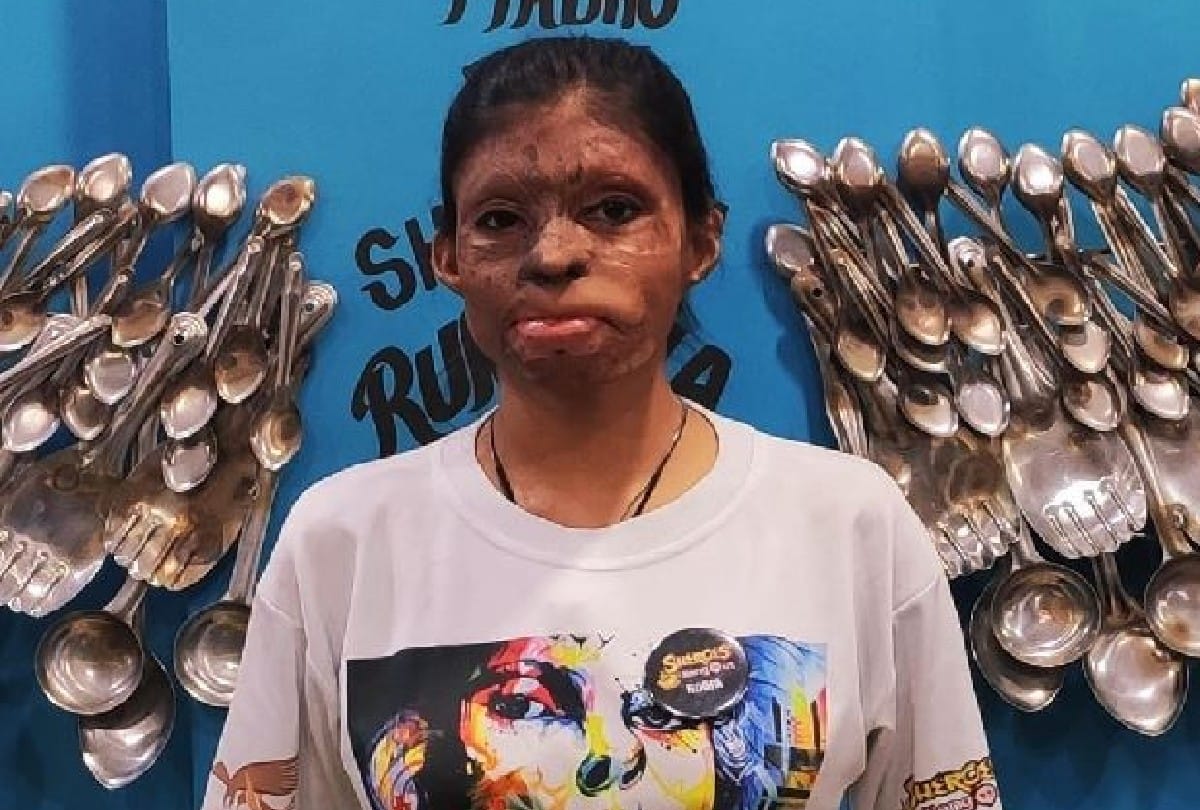 Aparajita 100 Million Smiles struggle story of acid attack survivors