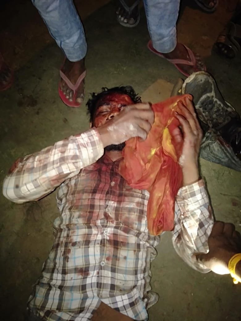 Pratapgarh: Attack on Pradhan's house, son shot