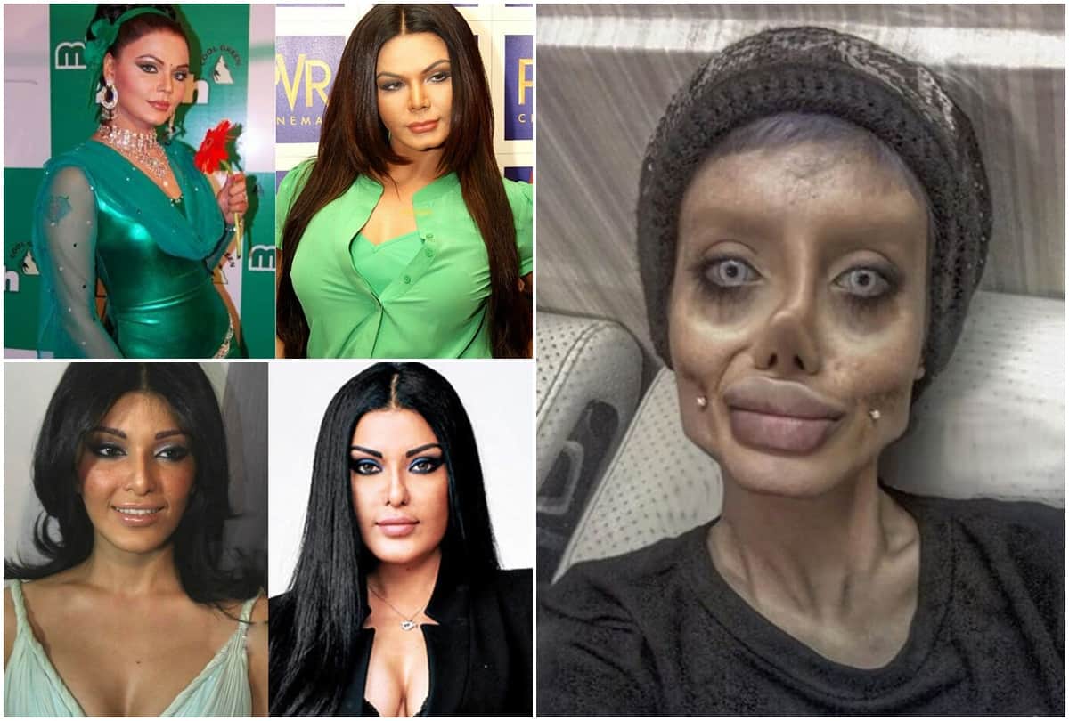 Rakhi Sawant koena mitra angelina jolie look alike actor Trolled For plastic surgery