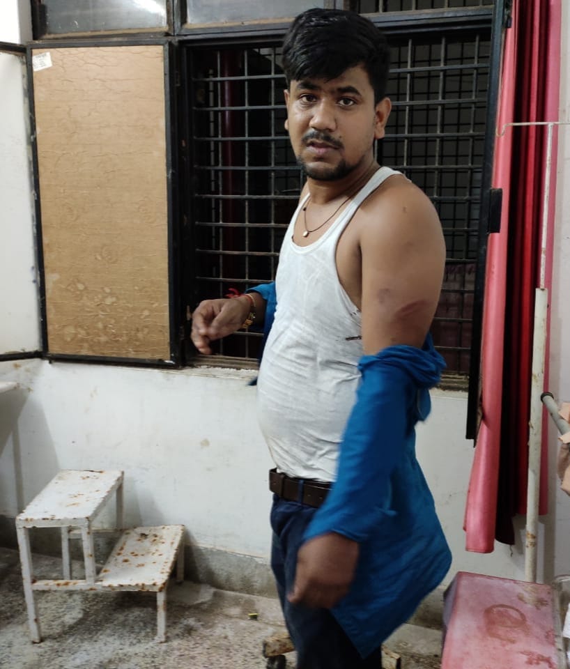 Attack on forest workers, forest injured, 11 injured including forest guard