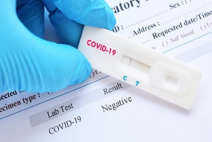 Prayagraj Corona News: From today, mobile teams will rotate through antigen test