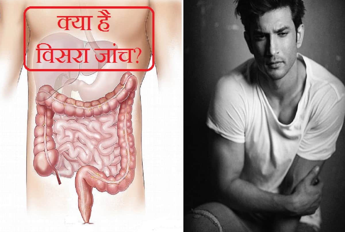 Sushant Singh Rajput Viscera report analysis know Everything about viscera