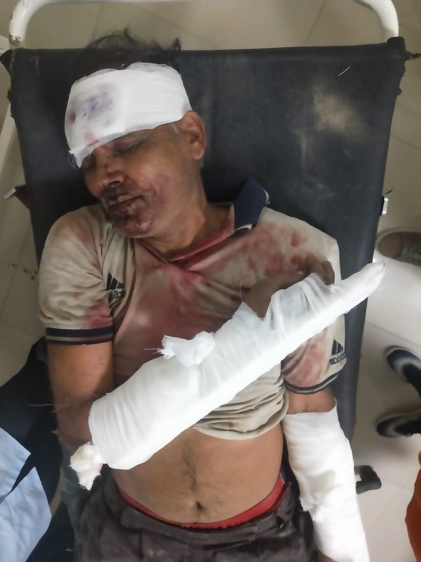 Three members of a family visiting the farm attacked by accused on bail