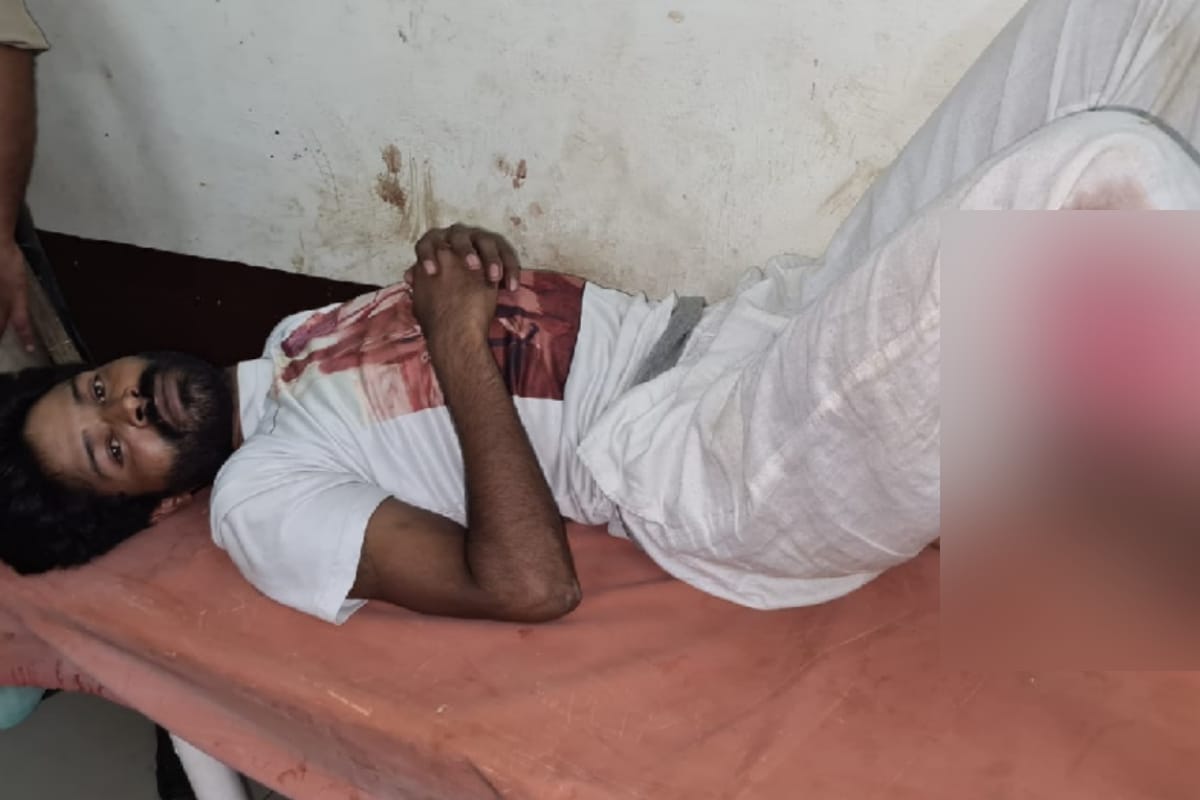 badmash worth of price mony injured in an encounter in shamli