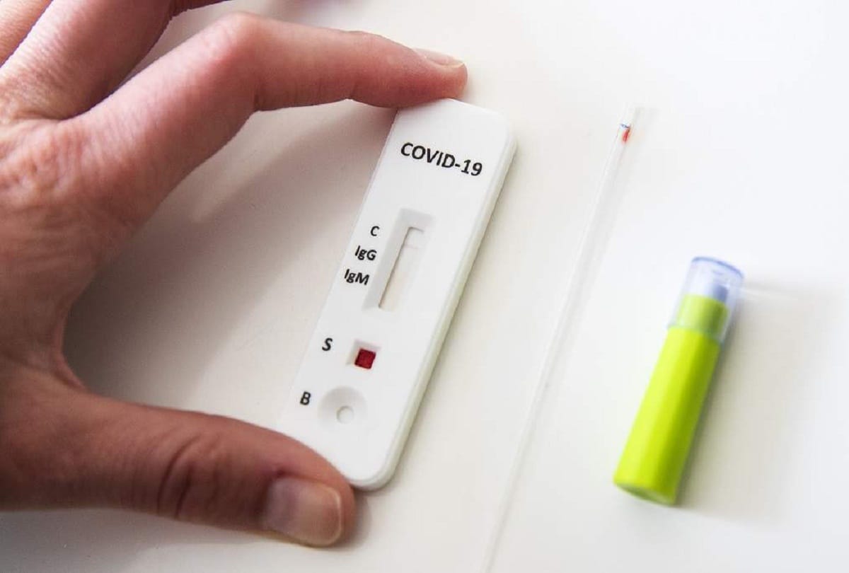 Prayagraj Corona Update: Antigen test will be free in 30 private hospitals