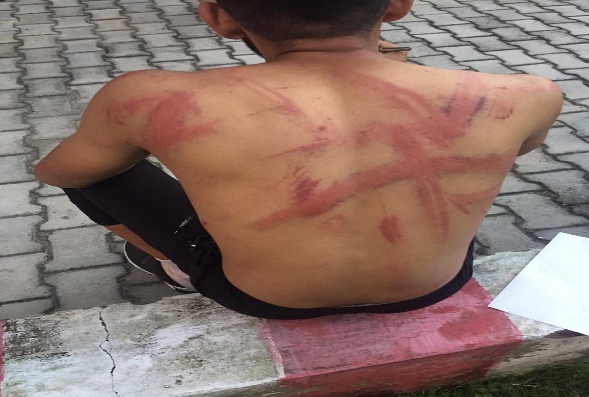 Hanumangarh: 15-year-old boy badly beaten with a rod, taken naked video