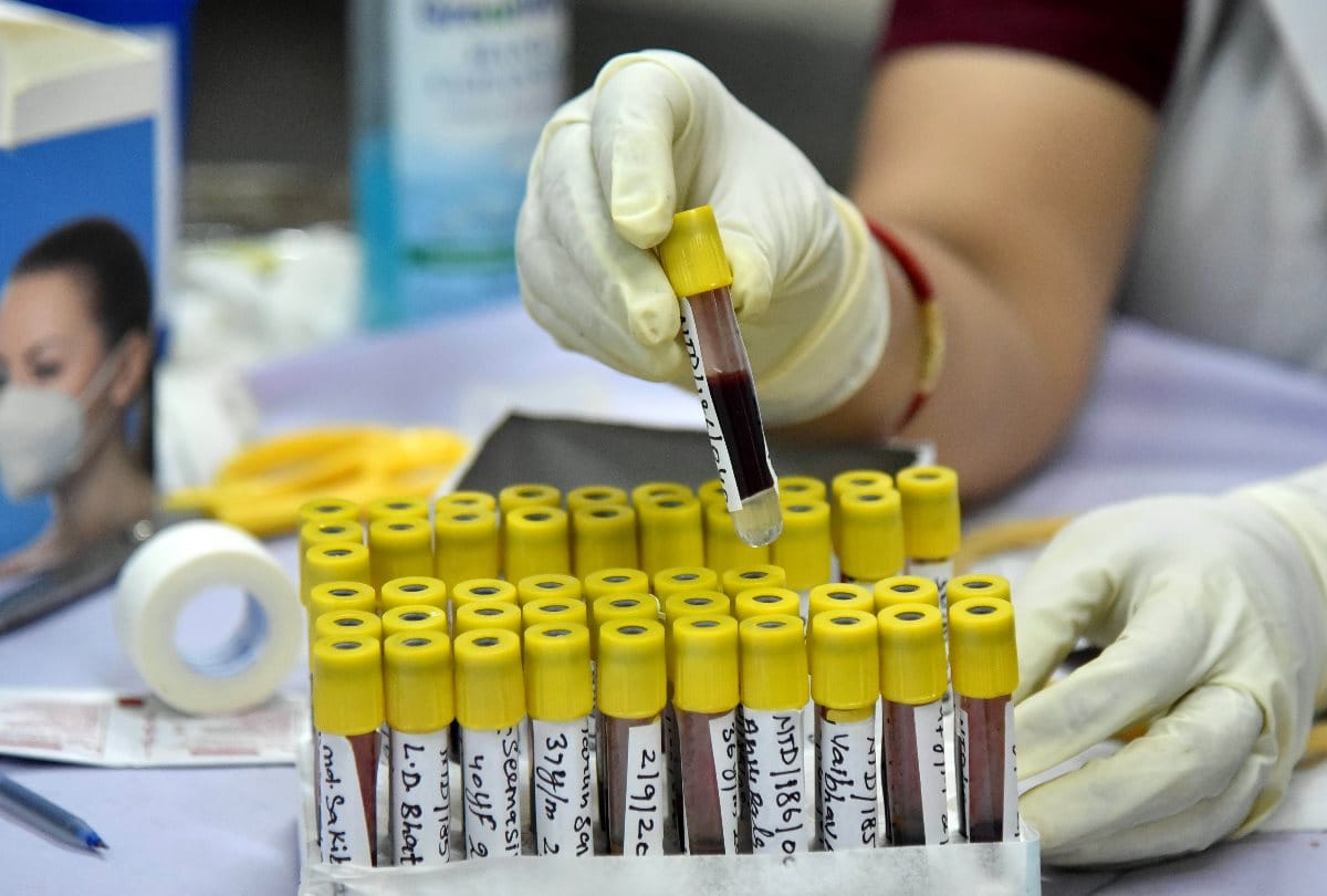 Corona vaccine news update UP government preparing for Covid-19 vaccine trials