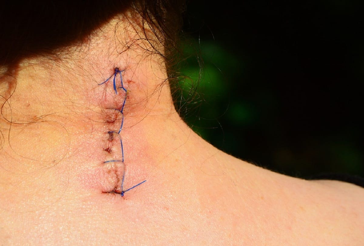 story of women who not hide her scars on her body