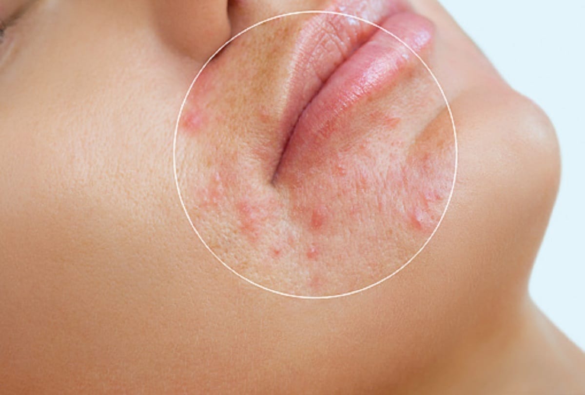 extraordianary benefits of jaifal for skin and body in hindi