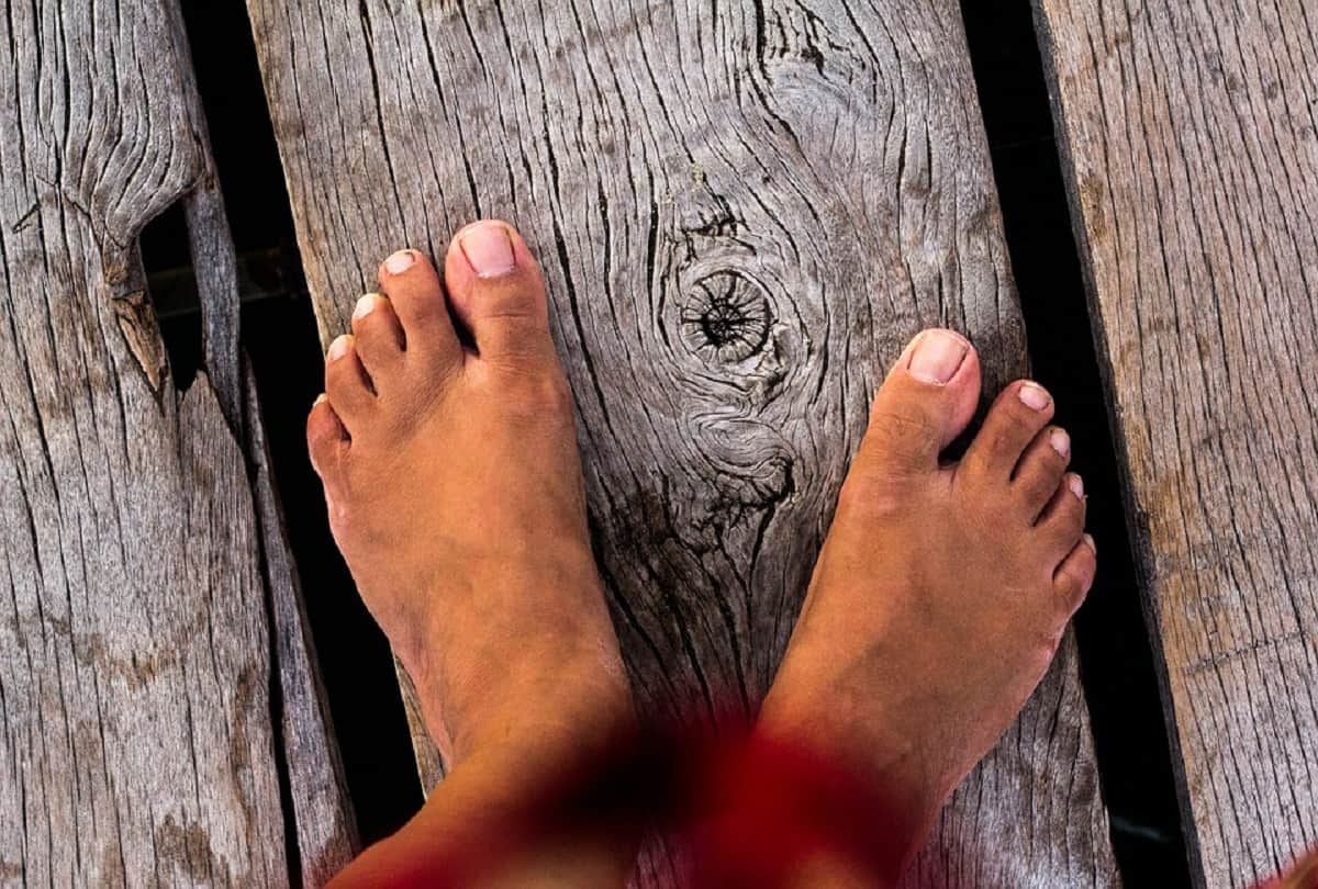 story of women who not hide her scars on her body