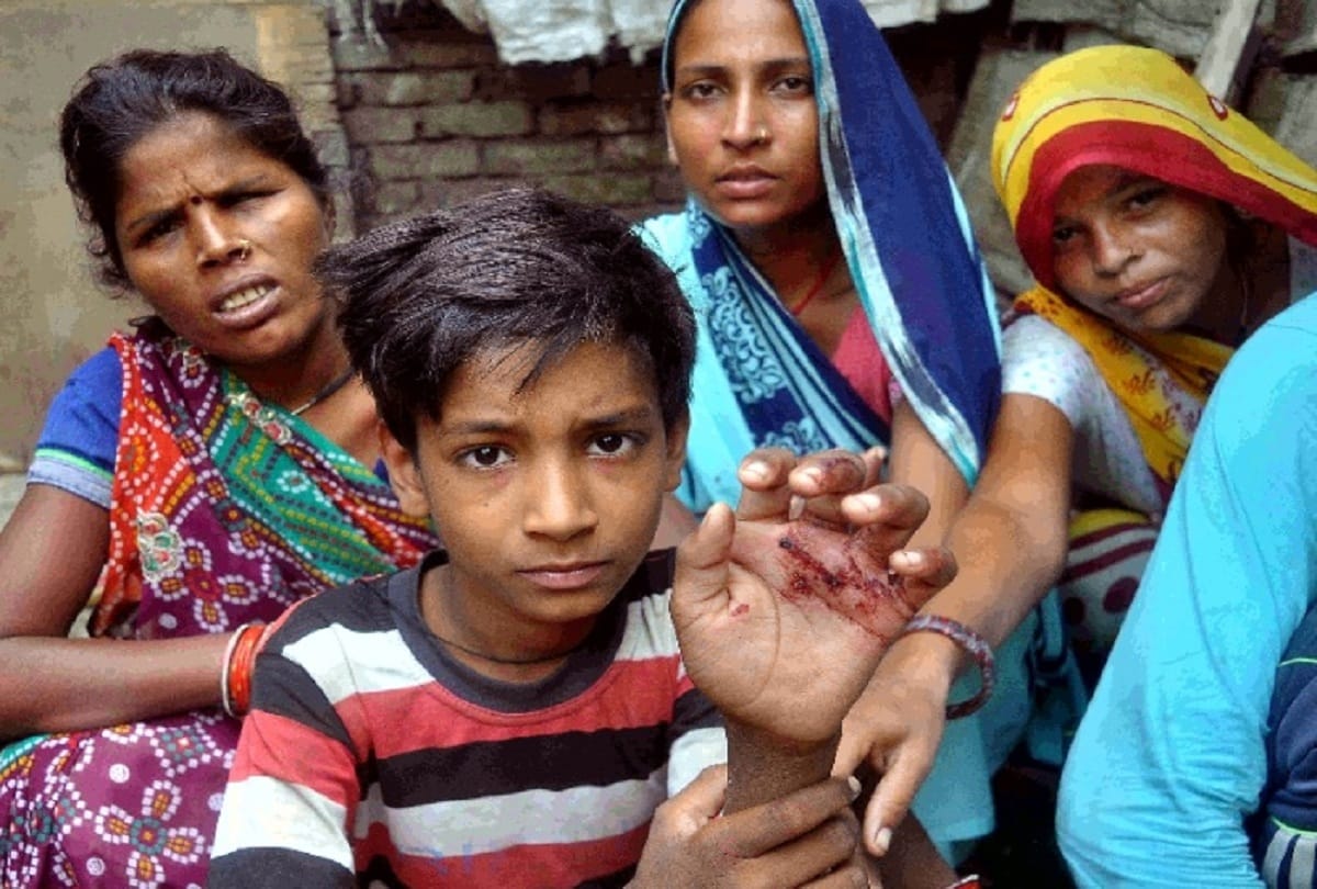 Crazy dog bites 17 people in 15 minutes two and half year old child condition critical see photos