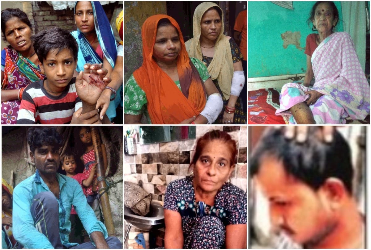 Crazy dog bites 17 people in 15 minutes two and half year old child condition critical see photos