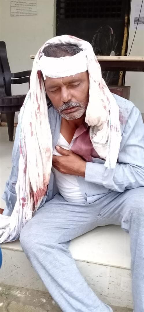 Hathras: Four people injured after a water pipe burst
