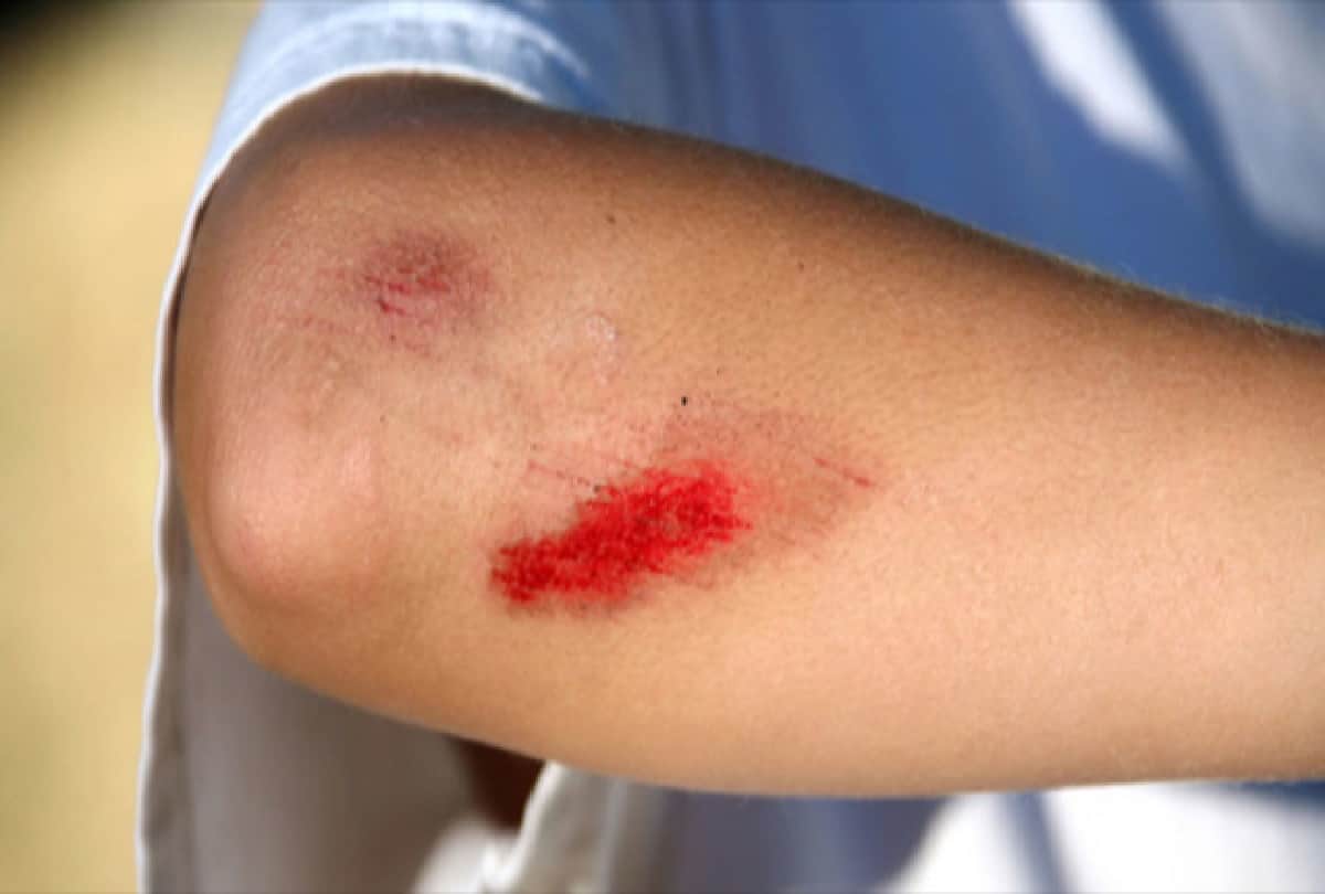 low immunity symptoms in hindi symptoms of low immune system signs of low immunity weak immune system signs and symptoms