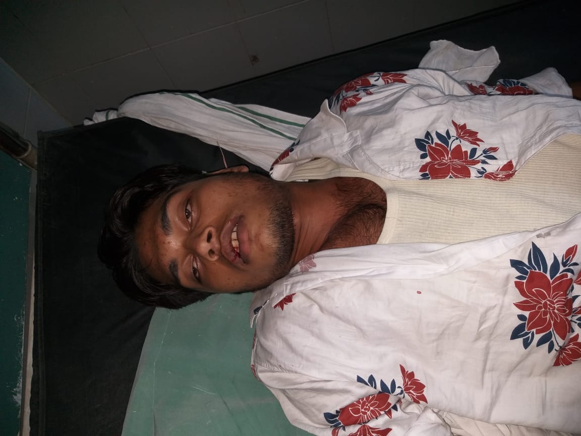 Two crooks injured in an encounter