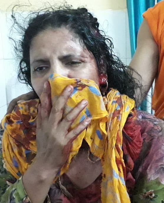 seven injured in normal disput also stone pelting