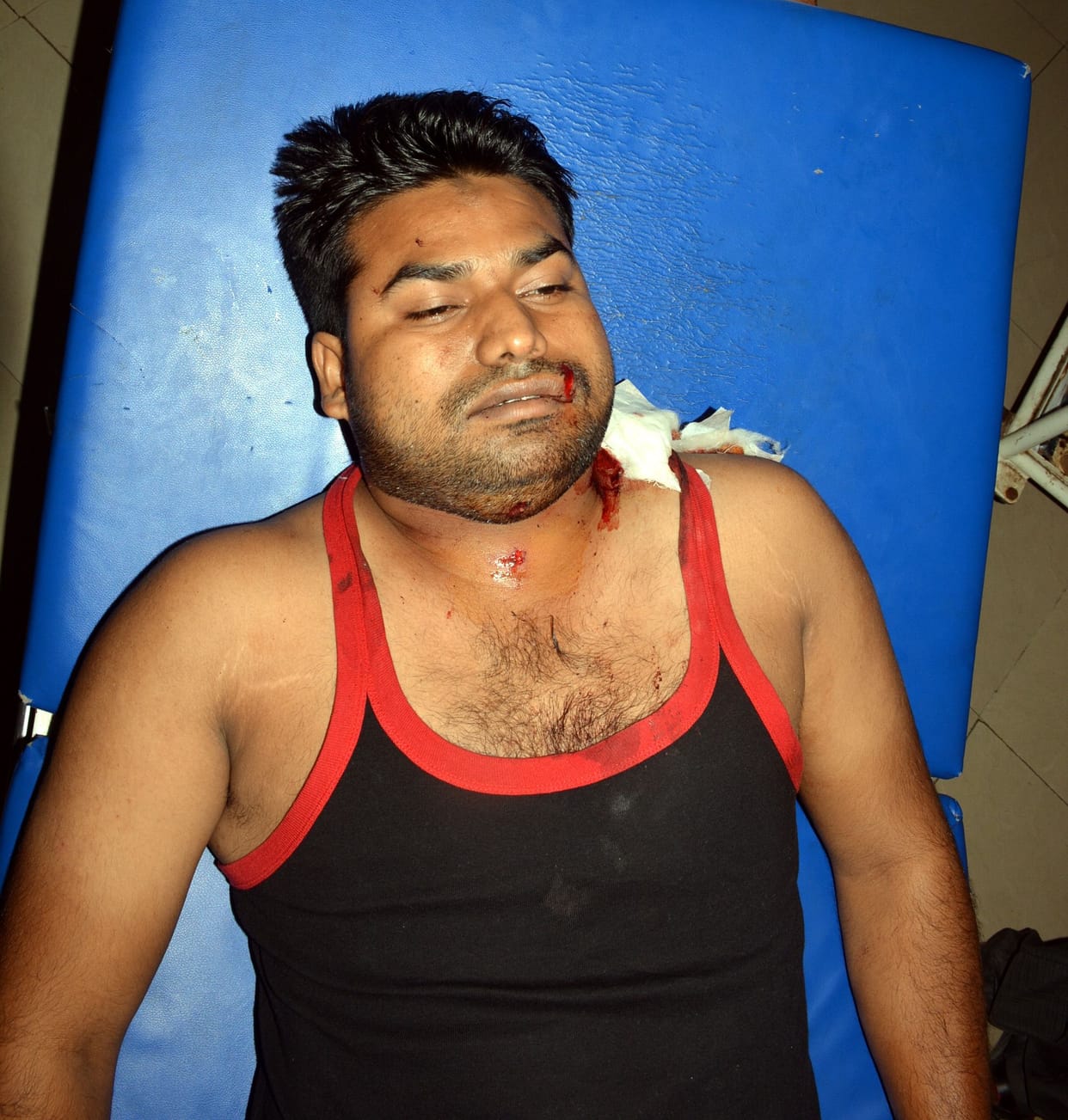 Two meat traders are going to the factory, firing, serious injury