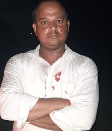 One lakh cash and four kg of silver robbery from bullion businessman in Bhadohi