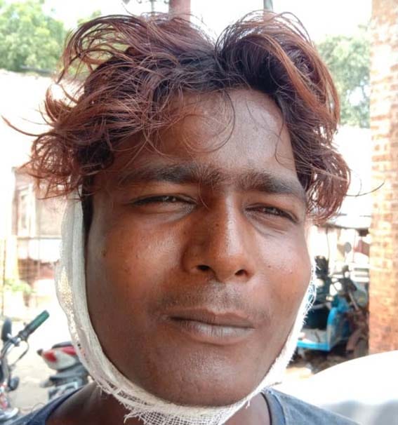 Lathis beaten to establish supremacy, five injured