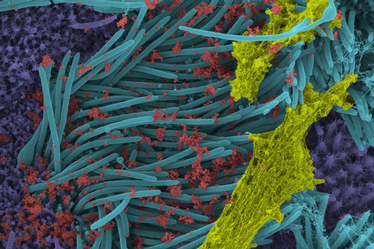 study shows cancer cells can evade from chemotherapy